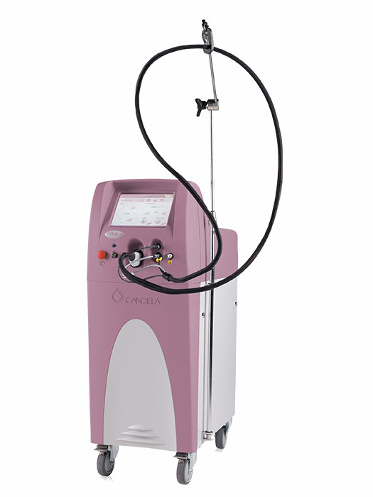 vbeam umbilical